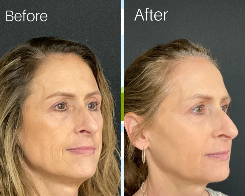 Cata-Kor NAD+ Anti-Aging Supplement (Buy 1 Get 1 Free)